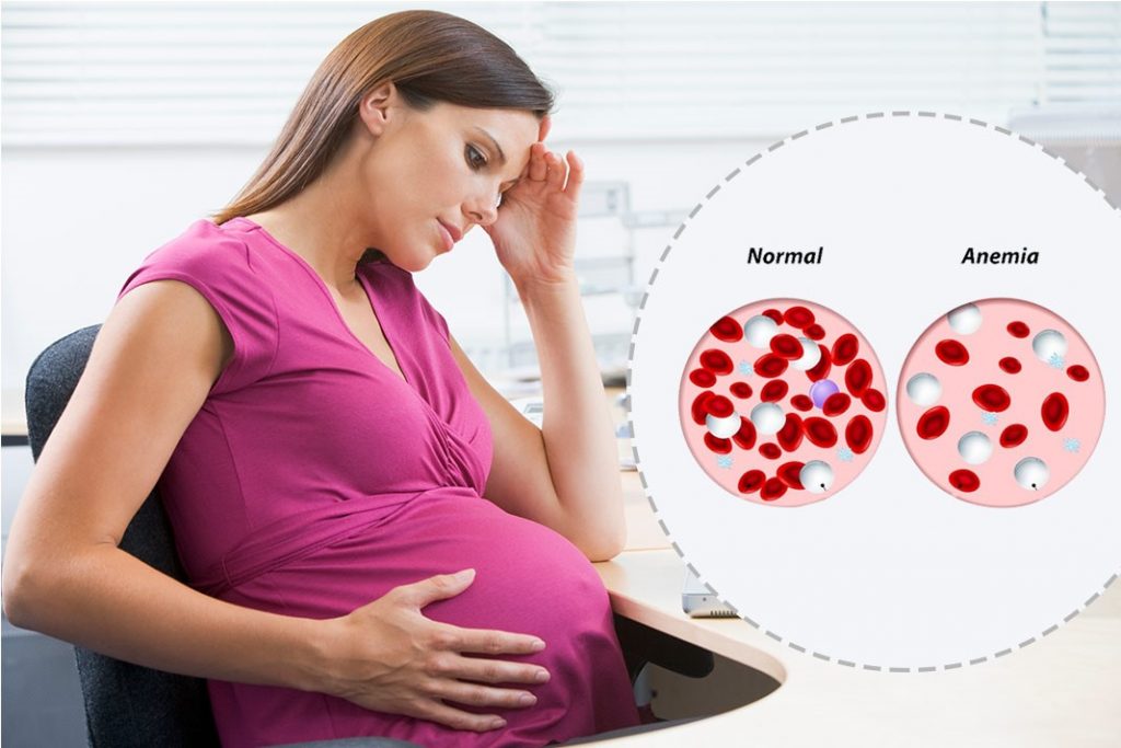 انواع کم خونی در بارداری