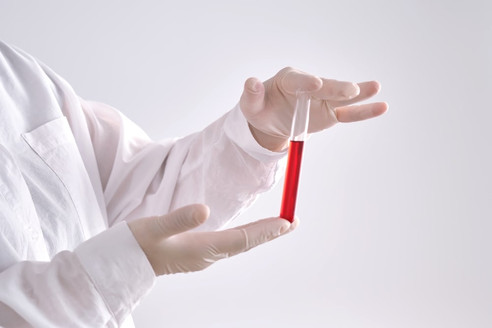 نحوه انجام آزمایش و آمادگی قبل از آن