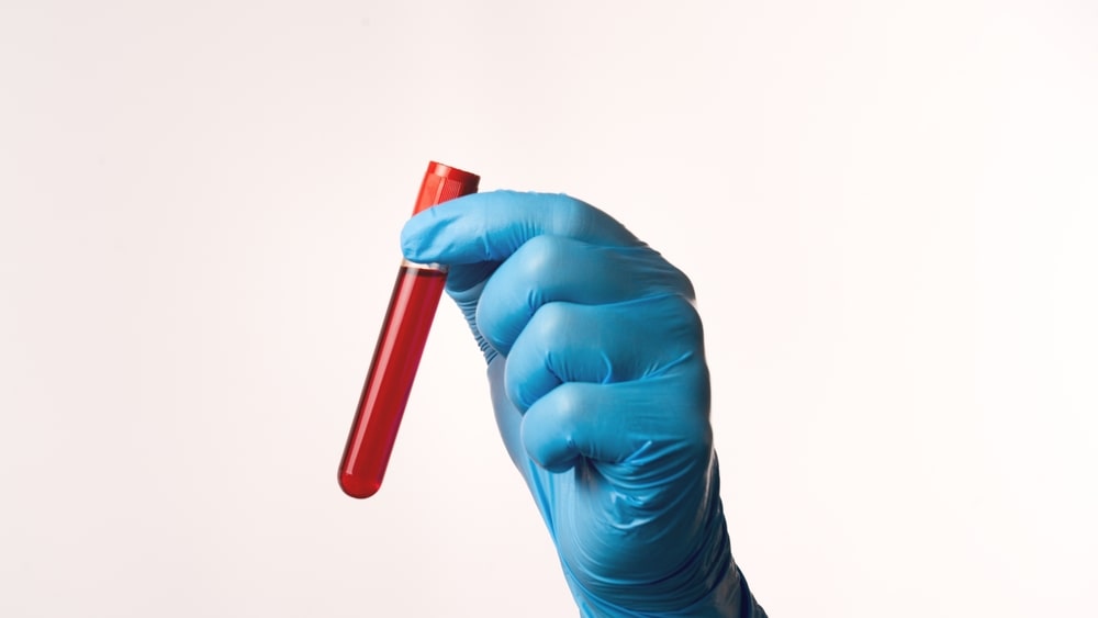 آزمایش گروه خونی و فاکتور Rh