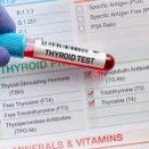 آزمایش تیروئید چیست؟ | تفسیر کامل آزمایش تیروئید