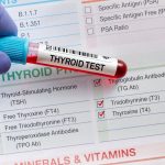 آزمایش تیروئید چیست؟ | تفسیر کامل آزمایش تیروئید