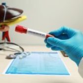 تفسیر آزمایش sgot و sgpt | آزمایشات کبد و میزان نرمال بودن