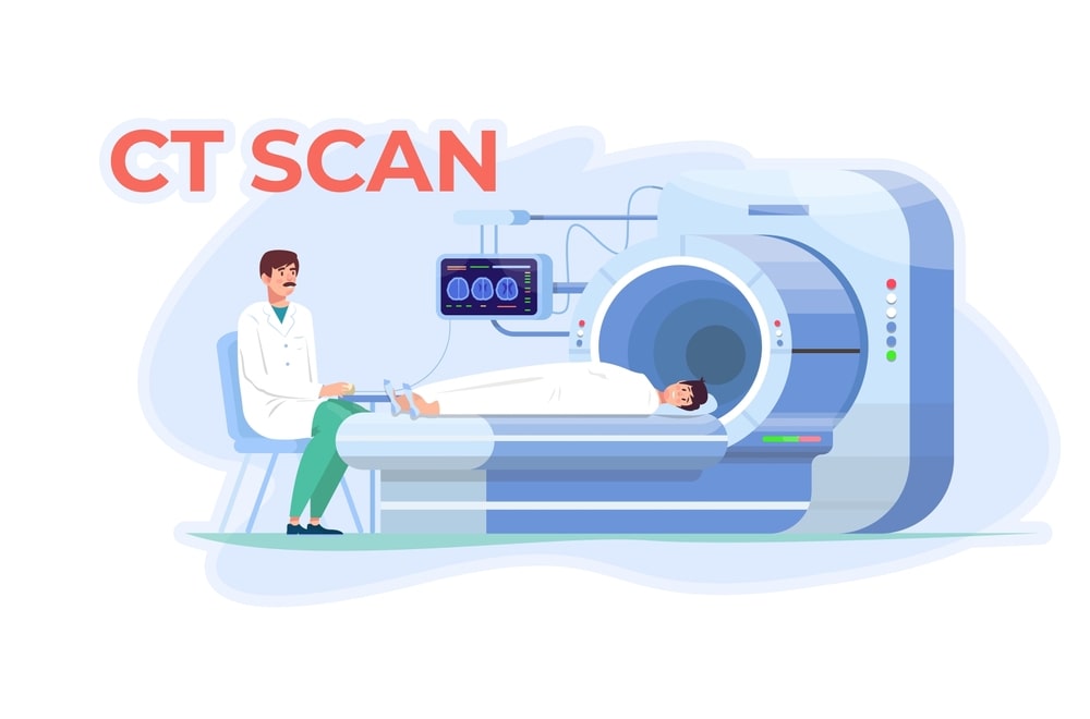 CT Scan سی تی اسکن چیست؟