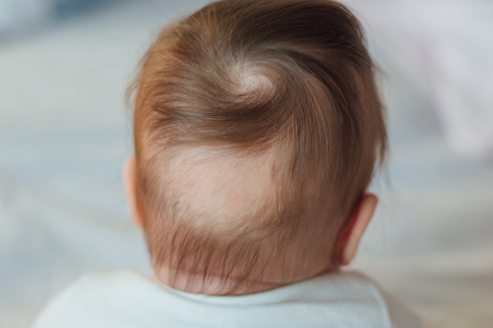 آیا ریزش موی سر نوزاد هم به لانوگو مربوط است؟